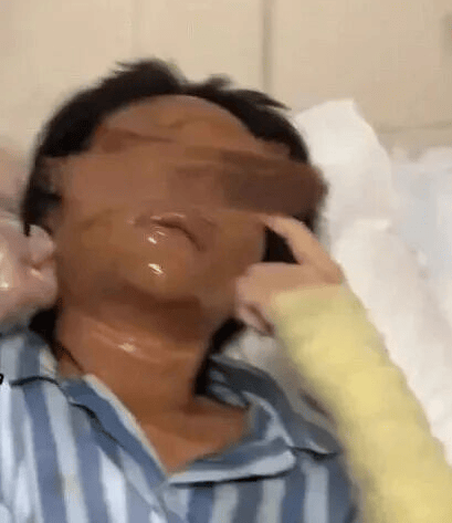 女主播被不明包裹炸伤毁容，警方通报