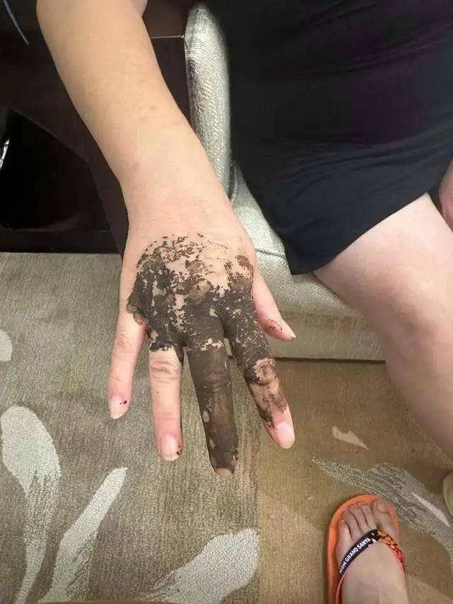 婆孙泳池边被毒虫咬伤，追责维权陷僵局；五星酒店：自然环境中蚊虫不可避免