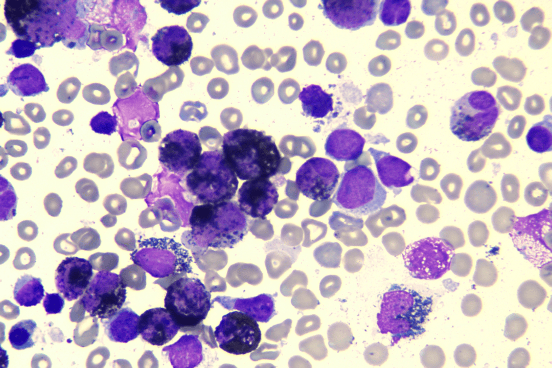 儿童单核细胞增高原因探索