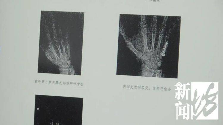 上海外卖员劝架，扑倒持锤行凶者！反被索赔12万？法院判了