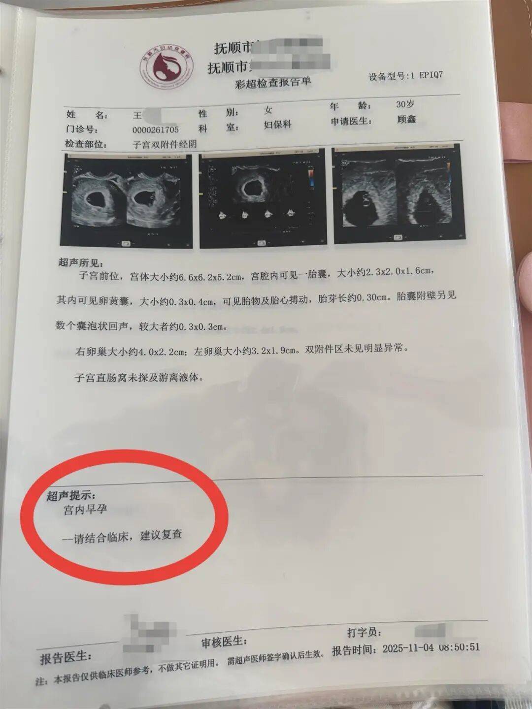 辽宁一孕妇两个月内从一胎变四胞胎