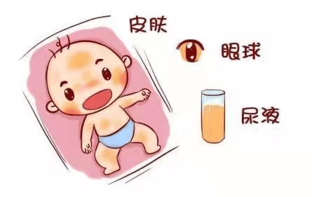 新生儿黄疸_宝宝_黄染_皮肤
