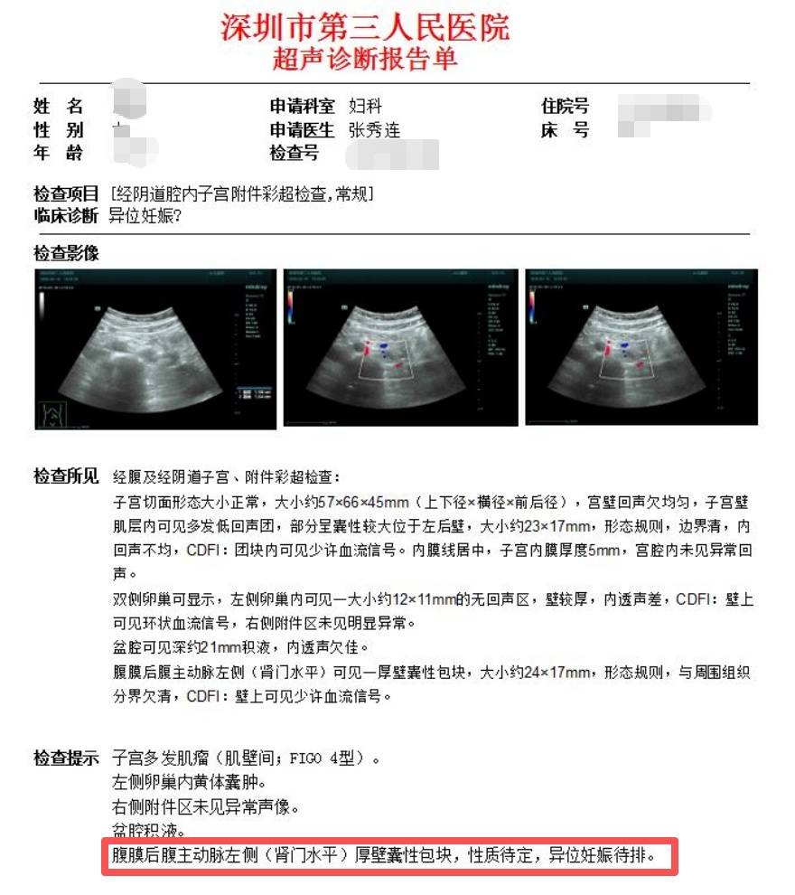 女子怀孕照B超却找不到“宝宝”,一查惊了,瞬间头皮发麻！