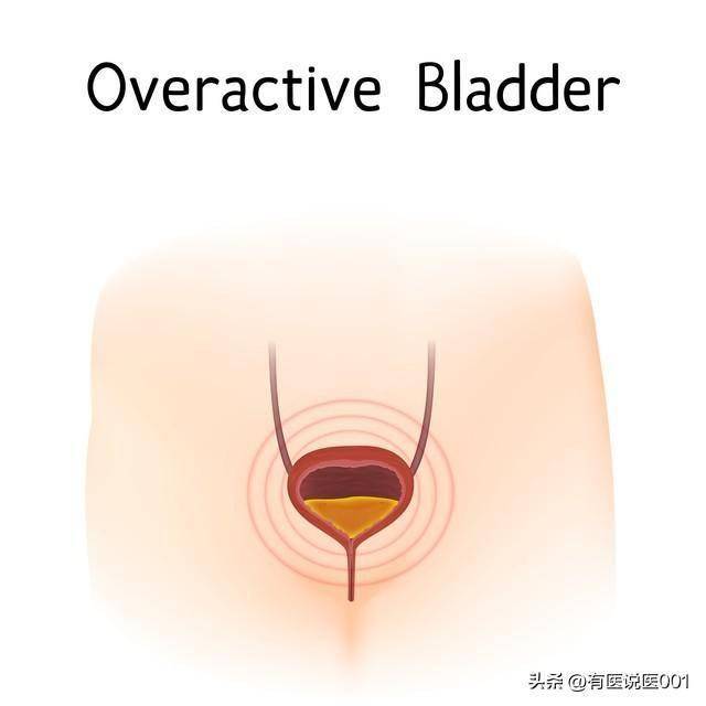 小胶囊三重守护男性生殖健康：改善勃Q、缓解早X、消除前列腺炎症