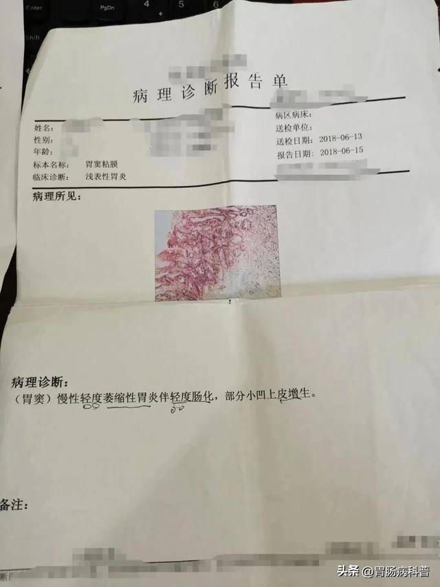 告别“萎缩”焦虑：中医如何巧治慢性萎缩性胃炎？常用方剂大盘点