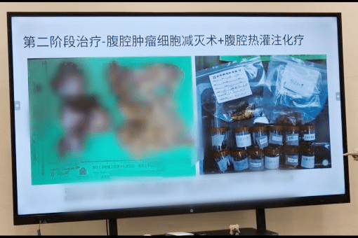 脱下白衣直面癌症 重披战袍照亮他人