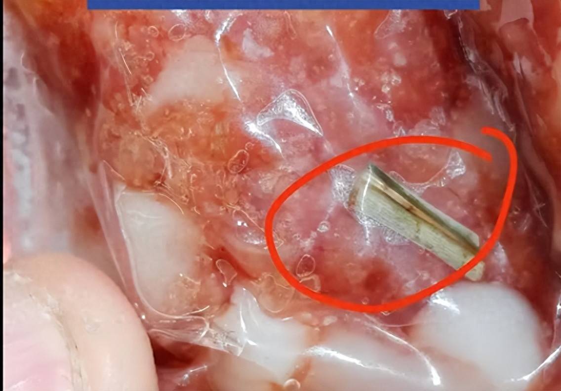 赣州章江大润发金鳌粒粒肠香肠现绿色异物 