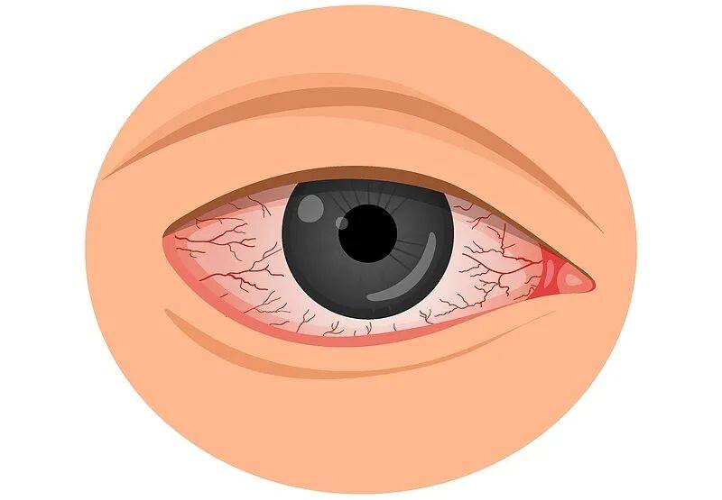 严重可致盲！这4个“毁眼”行为，不要再做了