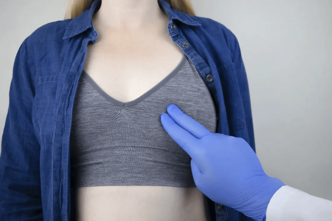 引产后涨奶几天能消失？乳腺自然回奶时间与舒缓方法全解析