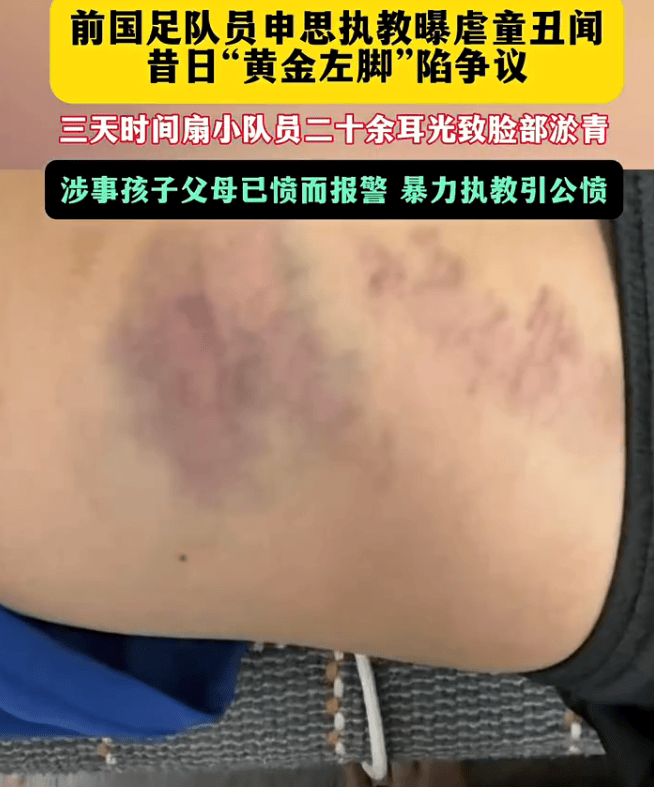 前国脚申思掌掴小球员、3天扇二十余记耳光 足协通报:已禁足(图4) 文章配图-1