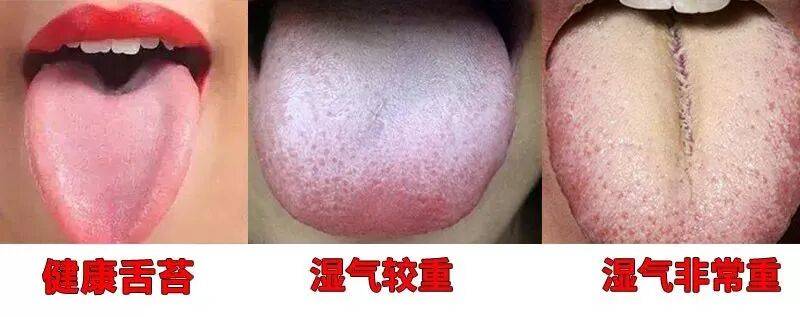 屁股上有个“祛湿总开关”，打开它，逼出20年的湿毒！