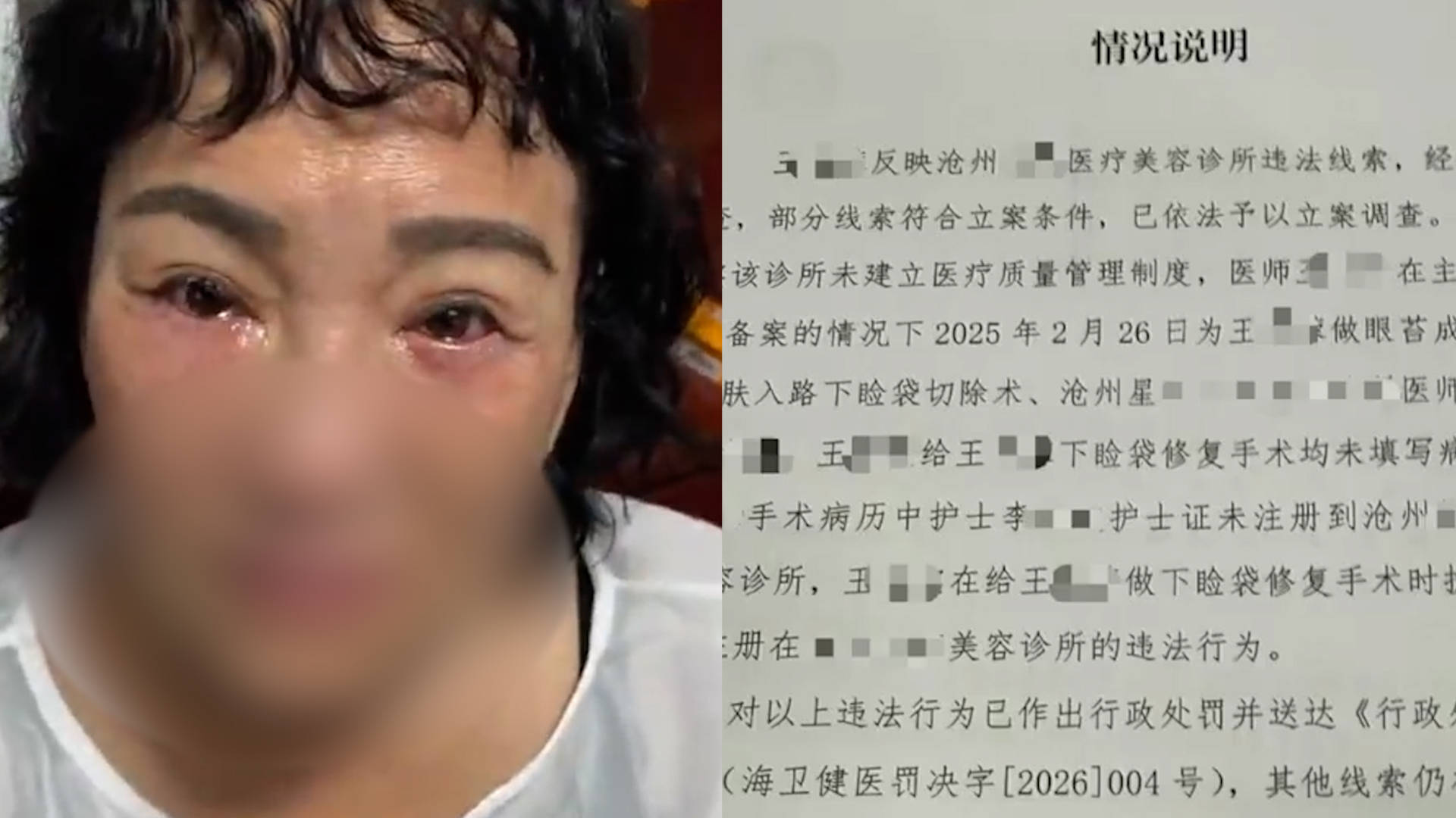 女子医美致眼睑九级伤残