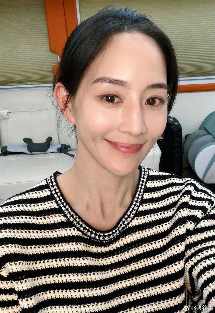 张钧甯自曝已完成冻卵手术