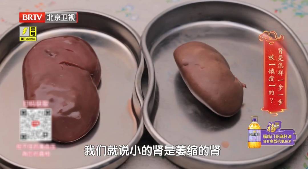睡觉有这个表现，警惕肾病风险！医生提示：出现3种情况，立即就医 (pic5)